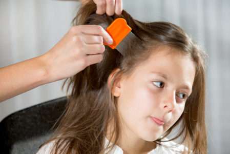treating head lice
